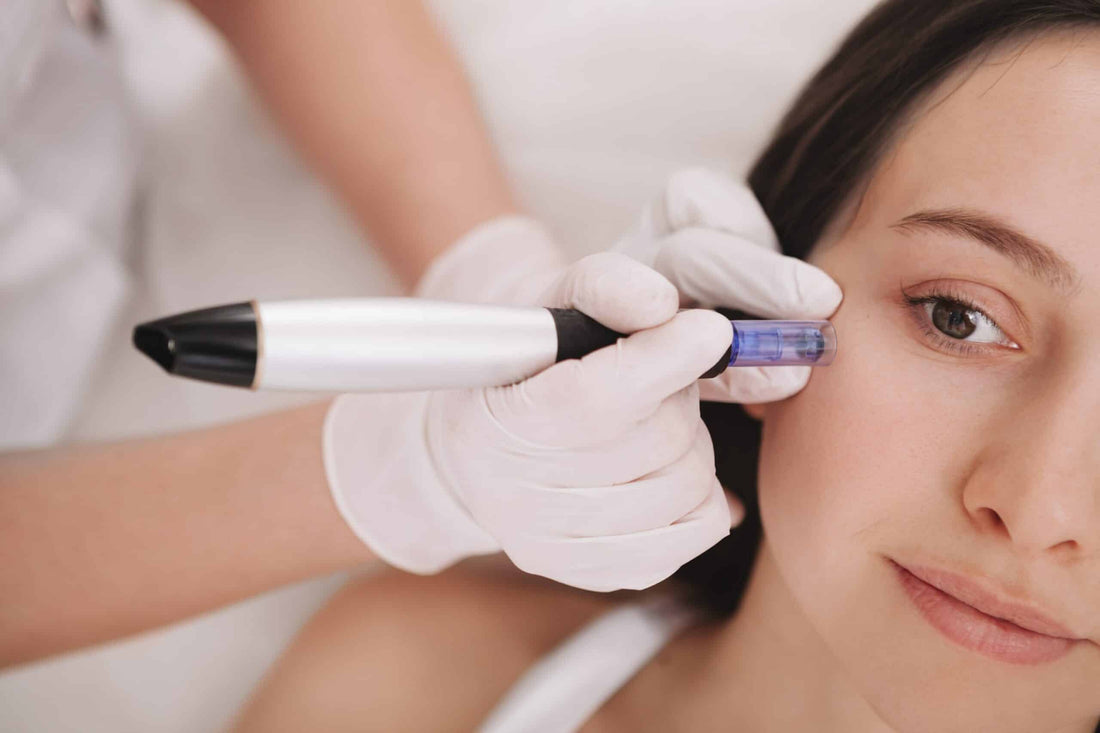 Micro-Needling aux vitamines, oligoéléments et acide hyaluronique (MESOHYAL NCTC 109)